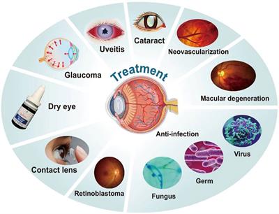 Recent development of polymer nanomicelles in the treatment of eye diseases